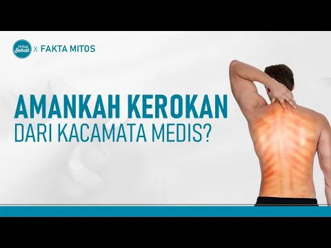 Melihat Manfaat Kerokan Dari Kacamata Medis