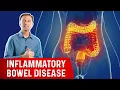 The Most Common Nutrient Deficiency in IBD Inflammatory Bowel Disease