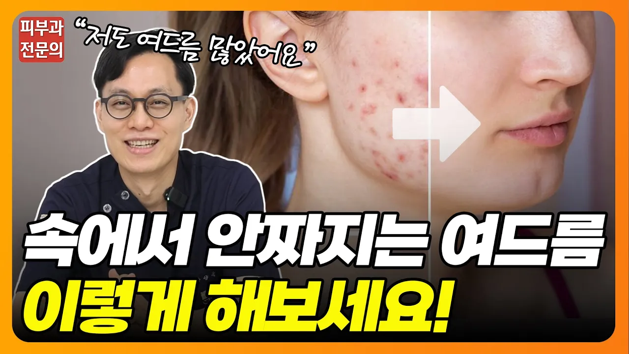 피부속 짤수 없는 여드름, 어떻게 해야되나요⁉ | 여드름 없애는법, 여드름치료