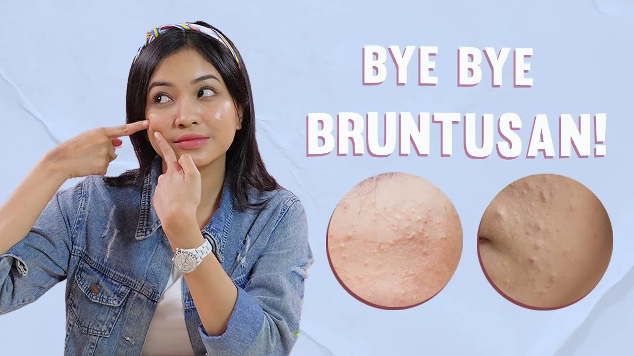 Tips Untuk Kulit Kering dan Kusam!. 