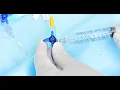 Reservoir Implantation CPT code - simplify medical coding