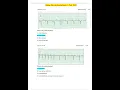Relias Dysrhythmia Basic A Test 2025 WITH COMPLETE SOLUTIONS GRADED A PROVIDES FULL EXPLANATIONS