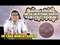 Download Lagu GEJALA ALERGI DINGIN YANG HARUS KAMU TAU (BIDURAN) DAN CARA MENGATASINYA - DOKTER SADDAM ISMAIL MP3