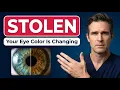 The Glaucoma Drop That Changes Your EYE COLOR - what your doctor won t warn you about