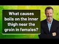 What causes boils on the inner thigh near the groin in females