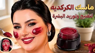 قولي وداعاً للتصبغات والهالات السوداء مع كريم الكركديه المبيض الفعال 🌺 🎀ا ✨️⚡️