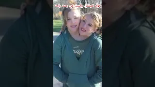 رأسان في جسد واحد 