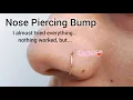 from my experience Nose Piercing Bump Removal at home