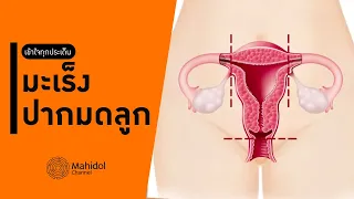 มะเร็งปากมดลูกเกิดจากสาเหตุอะไรบ้าง