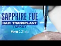 Download Lagu Sapphire FUE Hair Transplant Turkey #hairtransplant #sapphirefue #sapphirehairtransplant
