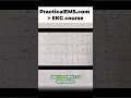 Lateral Wall MI Identify Heart Issues with This EKG Reading