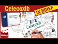 Celecoxib Celebrex What is Celecoxib Used For Dosage Side Effects Precautions