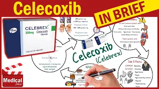 Celecoxib Celebrex What is Celecoxib Used For Dosage Side Effects Precautions