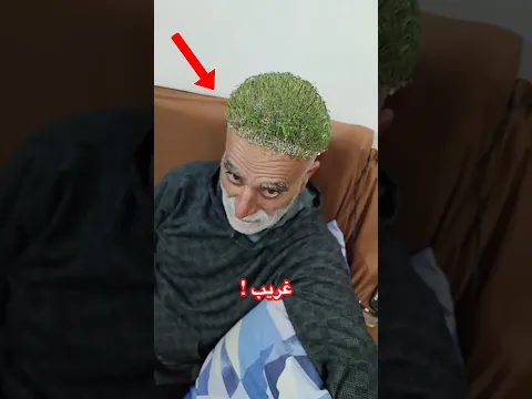مافعله هذا الرجل فى راسه غريب للغايه 😱 #shorts