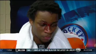 Wayne Simmonds bloody interview Ottawa Senators vs Philadelphia Flyers 31 March 2012 NHL Hockey