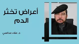 أعراض تخثر الدم 