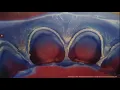 Channel