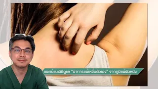 แพ้เหงื่อคืออะไร และเกี่ยวข้องกับโรคอะไร
