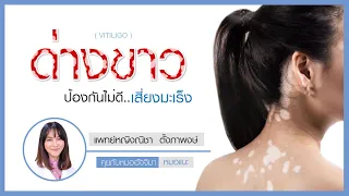 โรคด่างขาวเกิดจากสาเหตุอะไร และมีความเกี่ยวข้องกับโรคอื่นๆ อย่างไรบ้าง