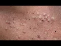 Satisfying and Relaxation with SURI NGUYEN Beauty Spa
