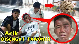 BENGK4K PARAH! WAJAHNYA ARIK DISENGAT TAWON YANG PALING BERBAH4YA SEPANJANG MASA?!😱 | Mikael TubeHD