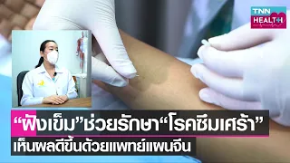 โรคซึมเศร้าในทางการแพทย์แผนจีนเกิดจากสาเหตุอะไรบ้าง