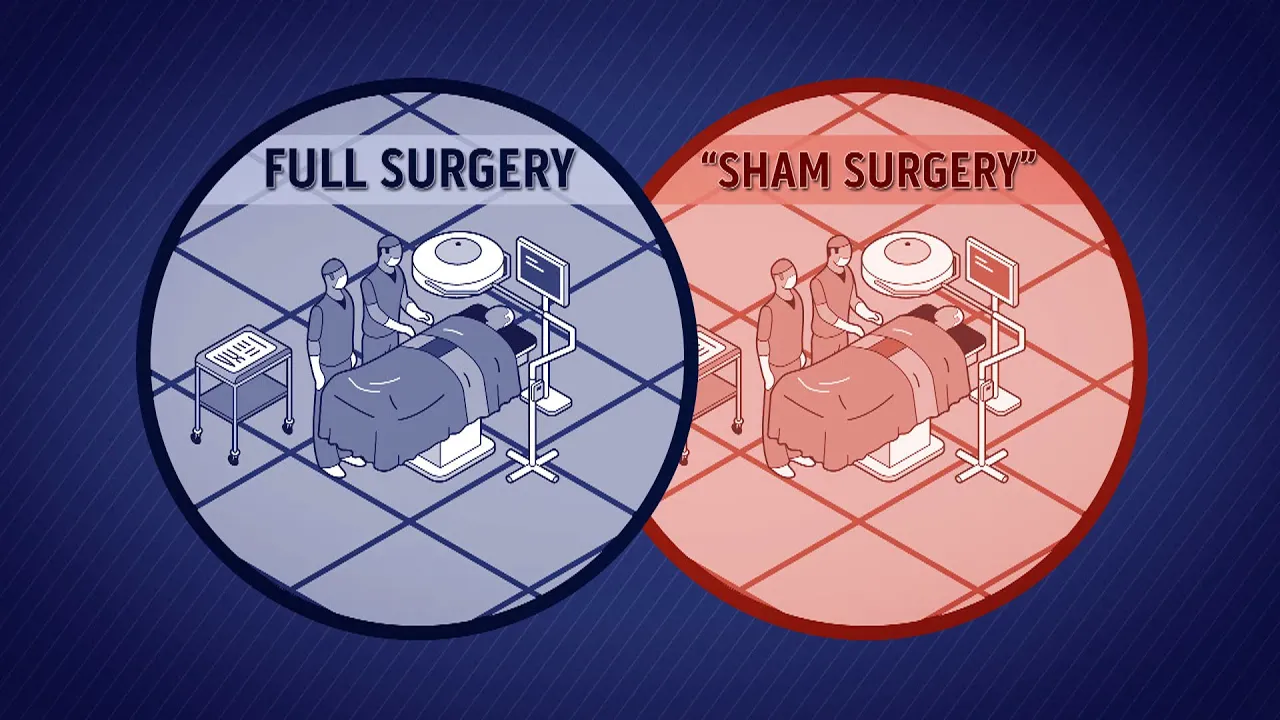 Sham Surgery /  Placebo surgery /  Placebo effect