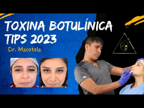 Download MP3 TIPS TOXINA BOTULINICA 2023