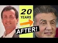 Sylvester Stallone 20 Year Hair Transplant 2020