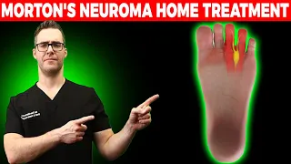 Download BEST Morton's Neuroma HOME Treatment [Shoes, Orthotics, Injections!] MP3