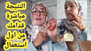 كتشوفي النتيجة قدامك من اول استعمال  ازالة التسبغات وتوحيد اللون لجميع الاعمار دندنها