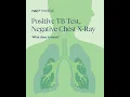 Positive TB Test Negative Chest X-Ray What Does It Mean