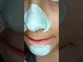 Download Lagu How To Remove Blackheads at Home ✨❤️|| #shorts #shortvideo #trendinghacks #viralshorts #short #hack