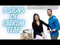 The 3 Simplified Signs of a Shoulder LABRUM TEAR
