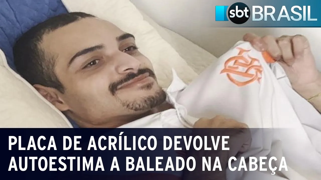 Placa de acrílico devolve autoestima a baleado com tiro de fuzil na cabeça | SBT Brasil (09/09/23)