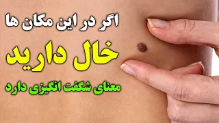 چرا در بدن خود خال دارید 