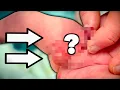 Download Lagu HELP! SOMETHING'S WRONG WITH MY BABY'S PENIS! (Hypospadias) | Dr. Paul
