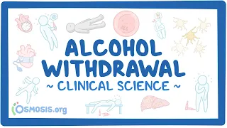 Alcohol withdrawal: Clinical Sciences