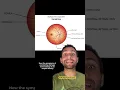 Doctor s Guide Solar Eclipse Causes Eye Damage