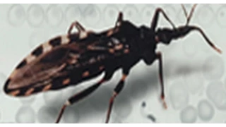 Doença de Chagas - Triagem e diagnóstico sorológico