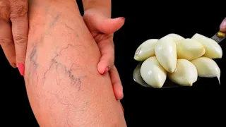 Leg pain, rheumatism, varicose veins, arthritis, headache, joint pain.