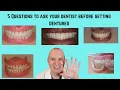 5 Questions to ask your dentist before you get dentures