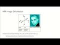1 0 - MRI image orientation with ANTsPy