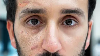 my evidence based skincare routine