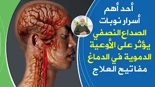 طعام يأكله الجميع يسبب الصداع النصفي والشقيقة يؤثرعلى الاوعية الدموية داخل الدماغ أهم أسرار العلاج 