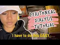 My Daily Peritoneal Dialysis TUTORIAL Amia Machine