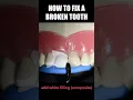 Download Lagu Tooth Filling #shorts