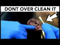 DON T Over Clean Your Piercings