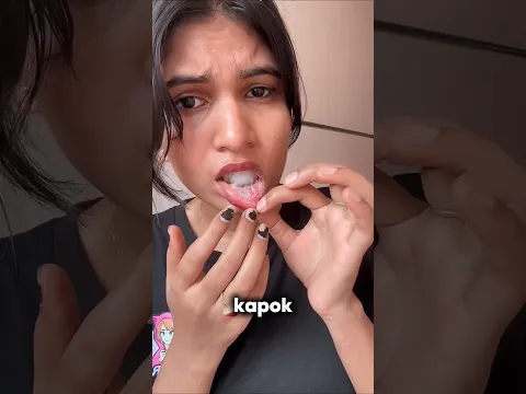 jangan melakukan ini jika sariawan#shorts #shortvideo