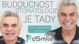 All-ON-X Dvě cesty do Turecka na tohle nestačí! Implantace v Praze